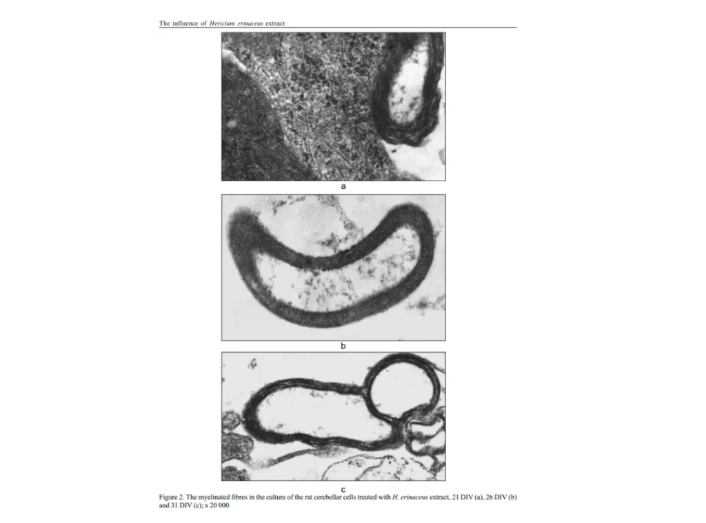 Microscopic images showing re-myelination in brain cells treated with Lion’s Mane Mushroom extract over 21, 26, and 31 days